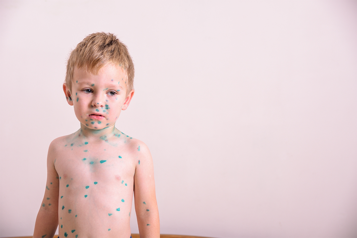 Consejos clave para el cuidado de la piel infantil segun expertos - La Relevancia del Cuidado Dermatológico Infantil